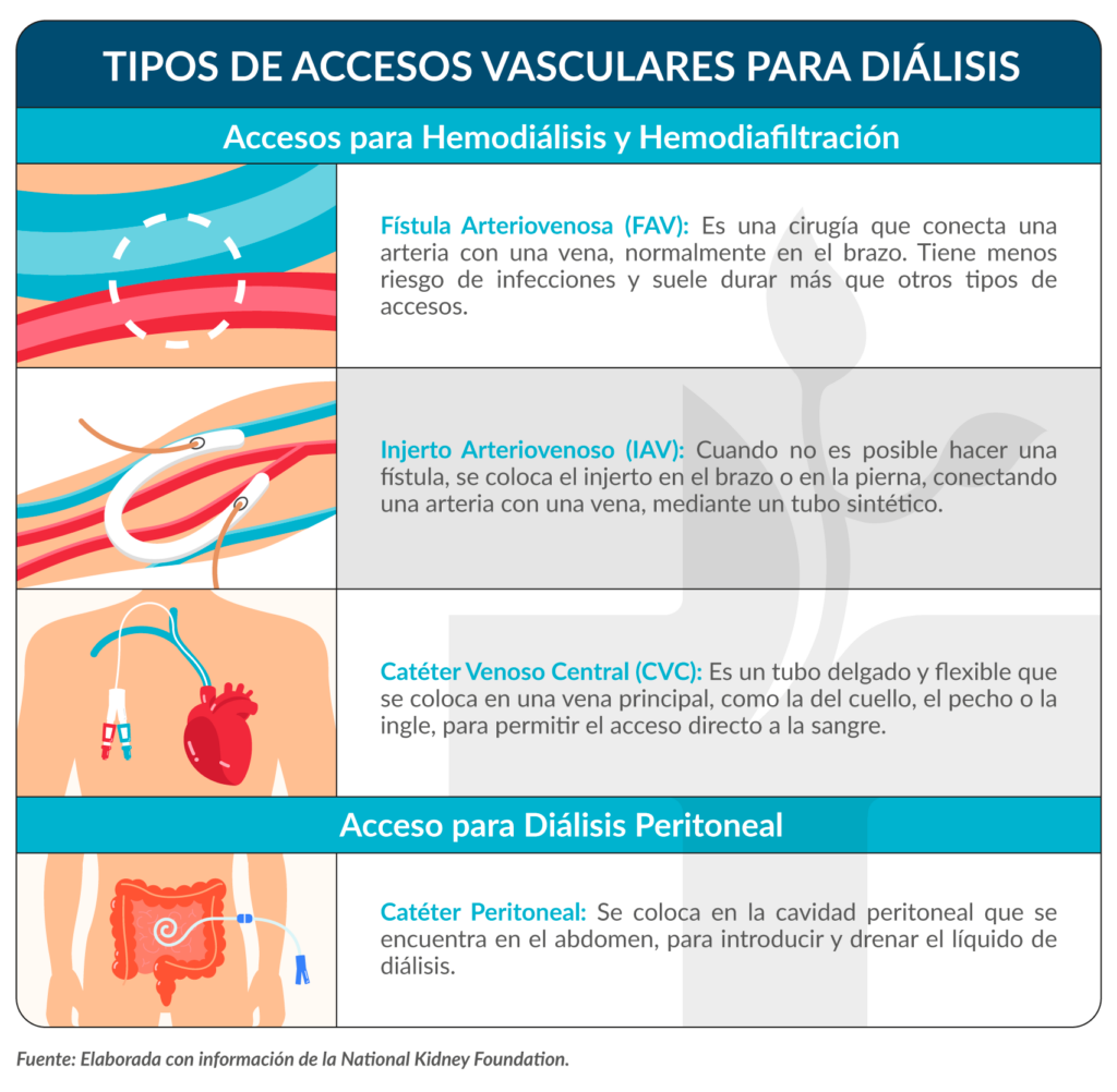 Tipos de accesos vasculares para hemodiálisis